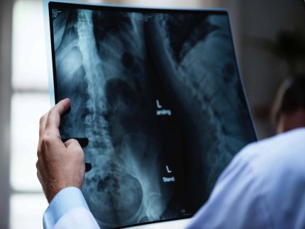 Tecnología para la predicción de la osteoporosis