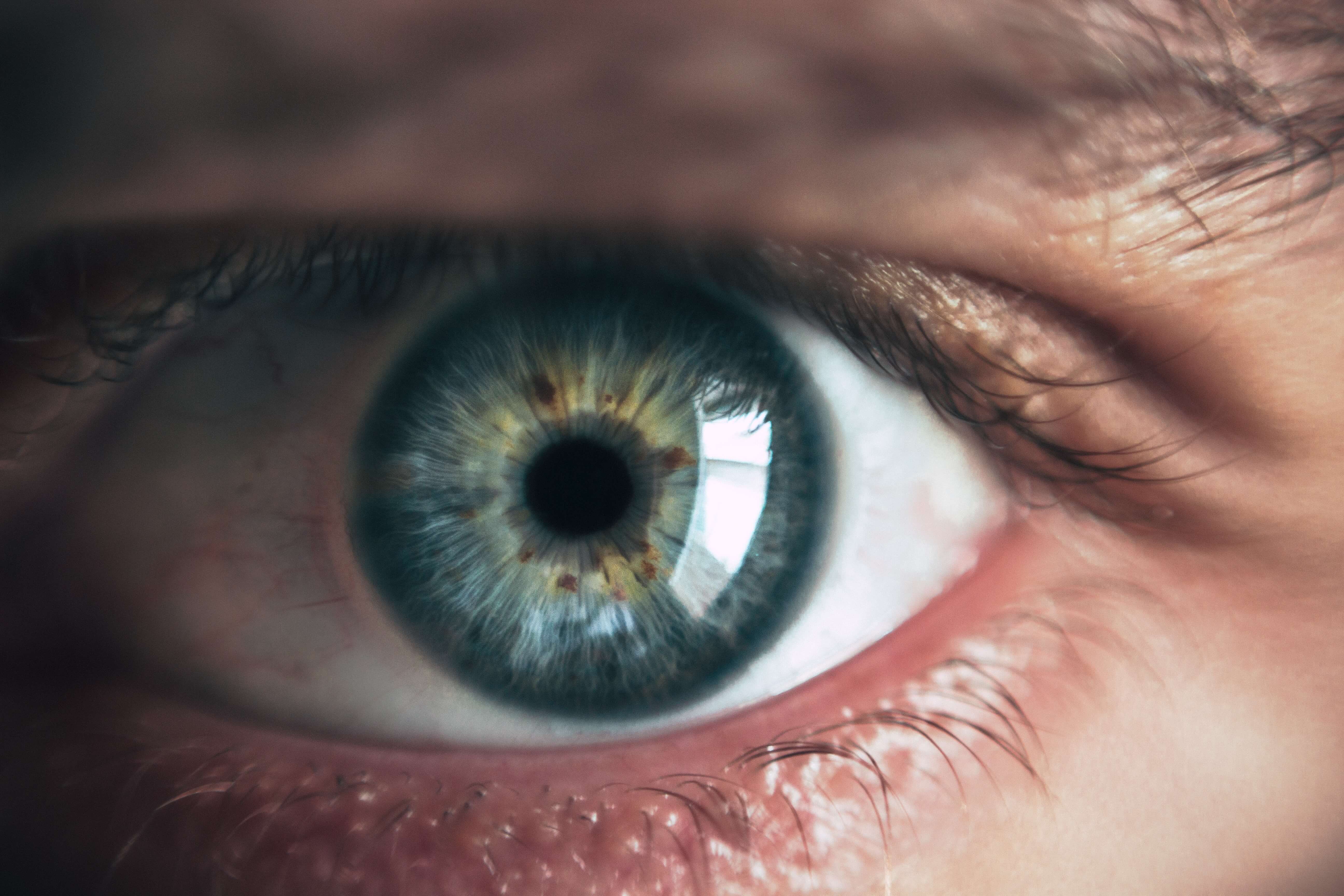 ¿Qué es y cómo afecta el glaucoma?